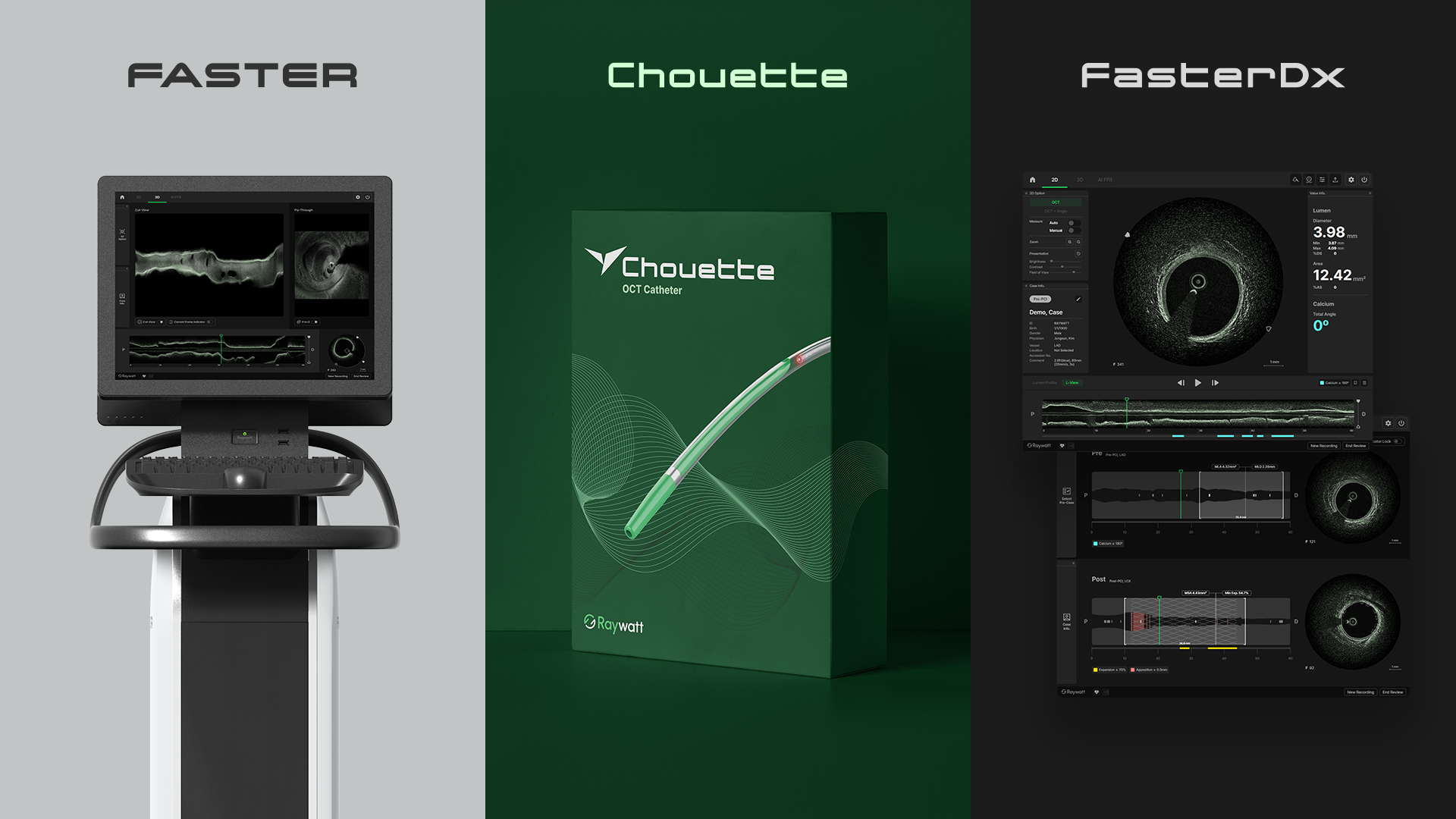 레이와트_SW(영상, 비젼, AI)개발자 채용